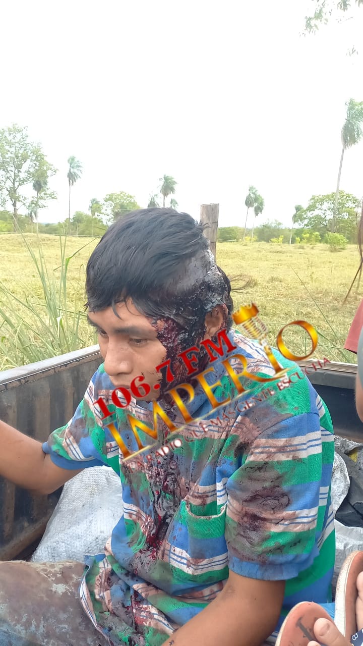 Joven indígena fue herido a machetazos en ronda de tragos